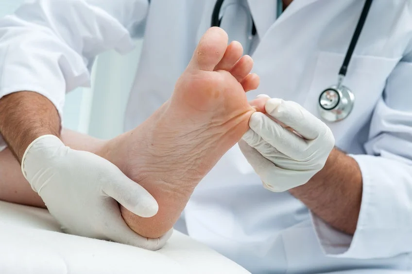 Kenali Gejala Kaki Diabetes dan Cara Pencegahannya